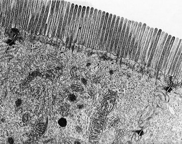 Simple Columnar Epithelium with Microvilli