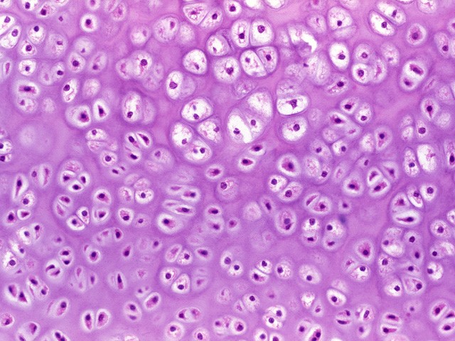 Hyaline Cartilage