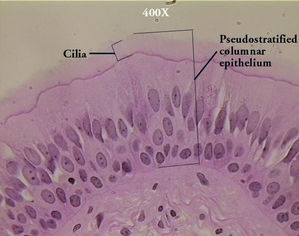 Pseudostratified Columnar Epithelium