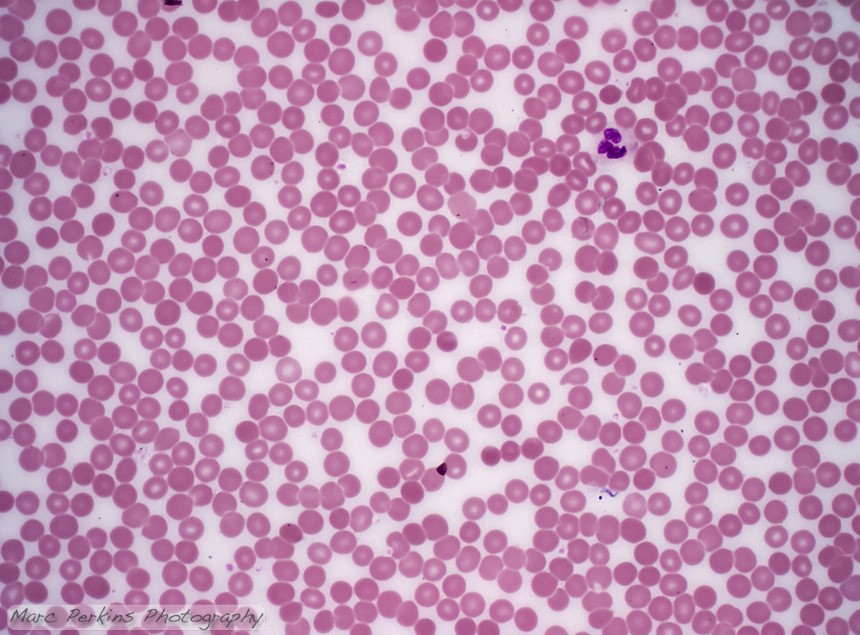 Red Blood Cells